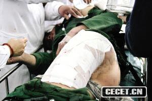 FOıͽֵڹٱ׌ͿƮܛʯKȼƿuٱһ(g)ͽıʯK侯ʿƨD܂侯ʿڽί