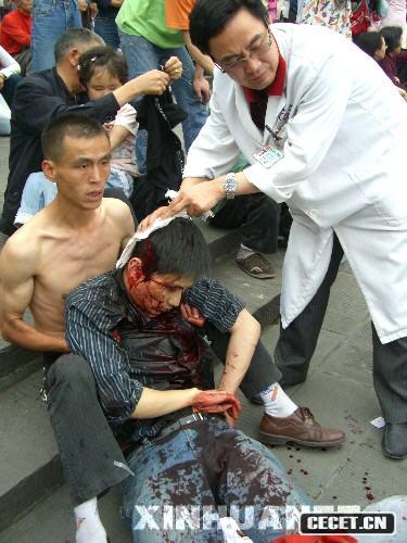 14r(sh)28Ĵ봨hl(f)7.8x봨s100ĶвOʩܓp̎ݰl(f)ĿǰrڽyӋ֮